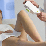 Konya’da Buz Lazer Nedir?